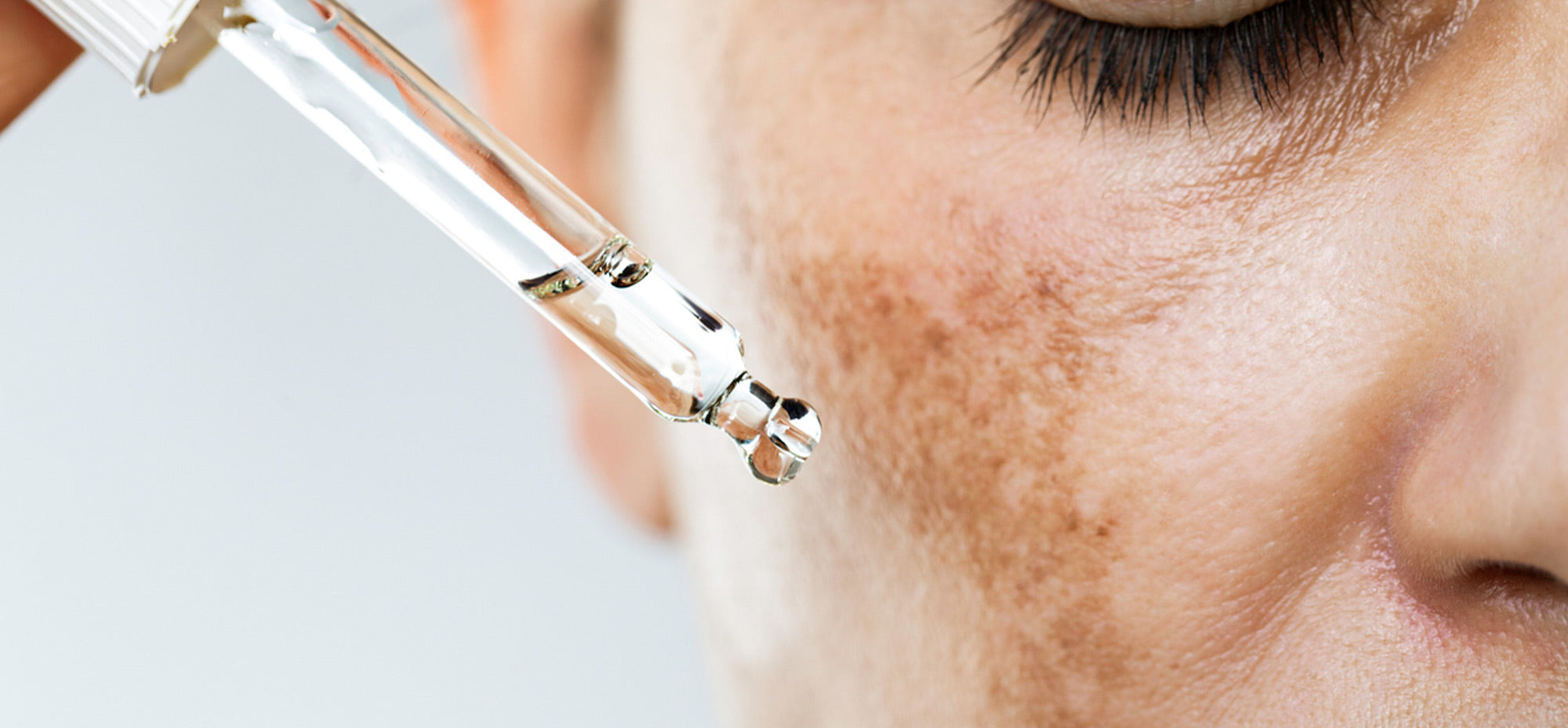 Dark Spots / Sun Spots (Brightening)