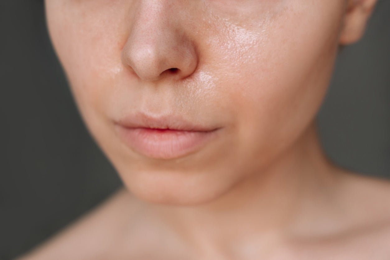 Oily Skin
