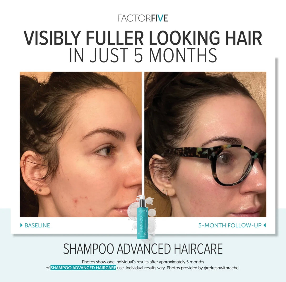 FACTORFIVE Advanced Haircare Shampoo