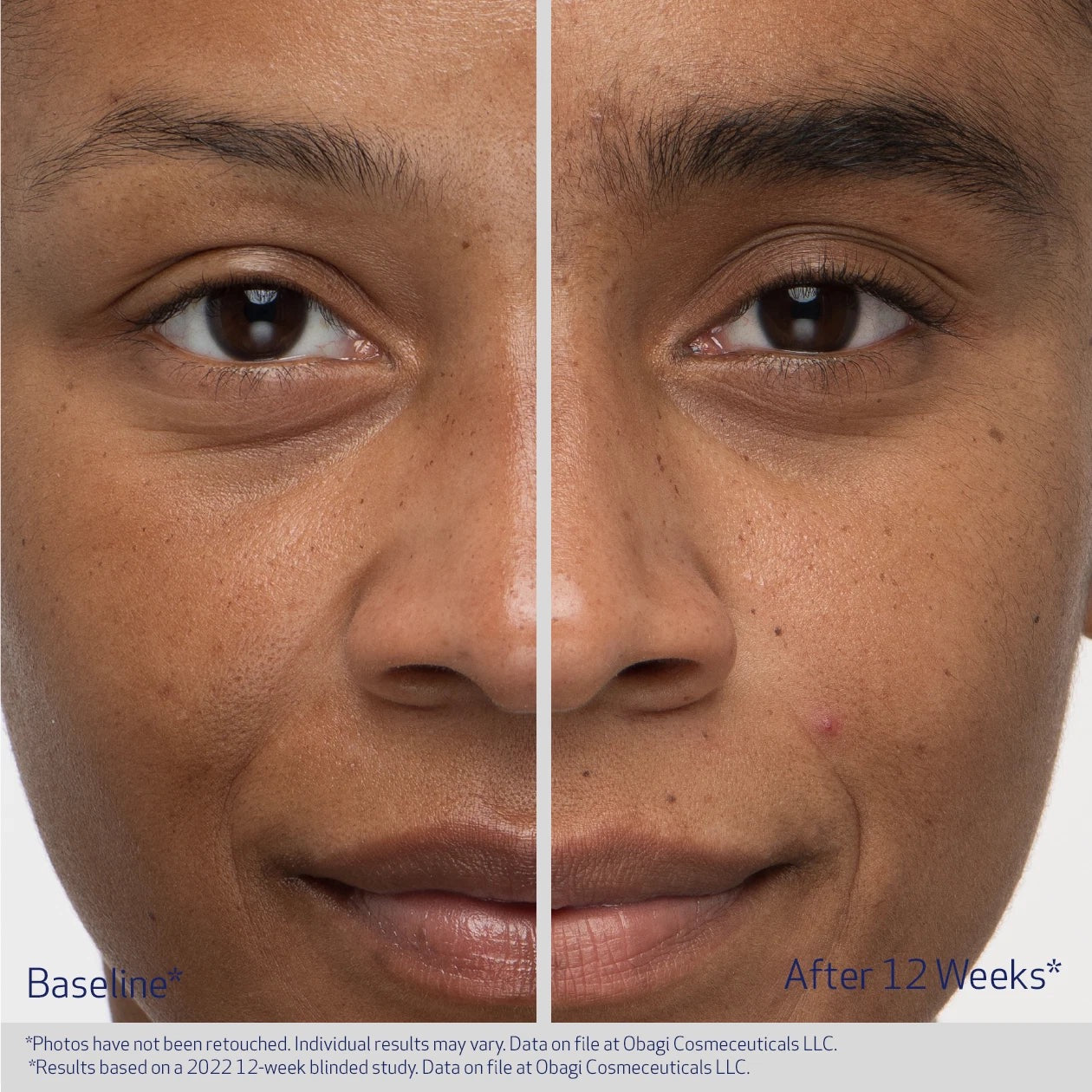 Obagi Eyebrow Boosting Serum