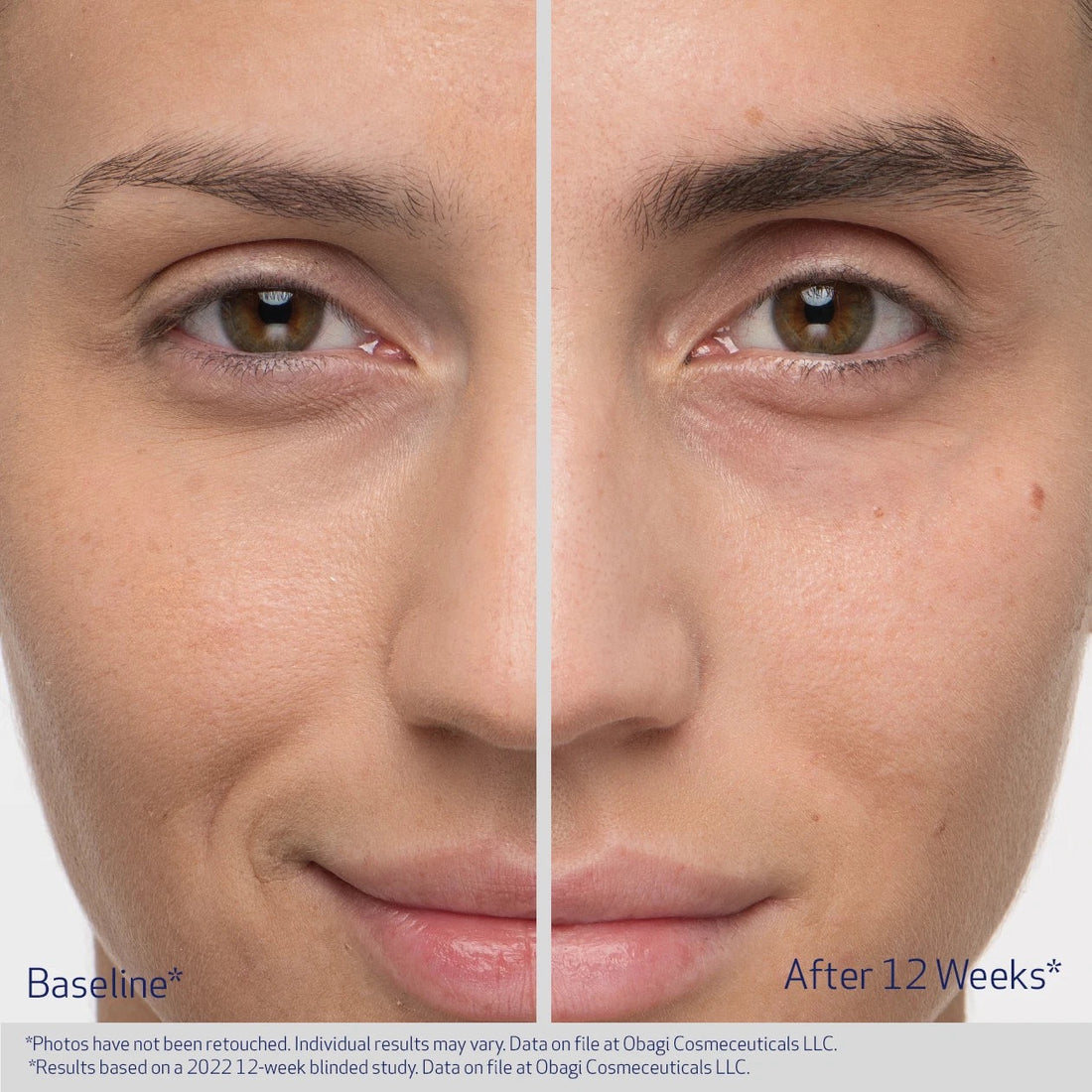 Obagi Eyebrow Boosting Serum