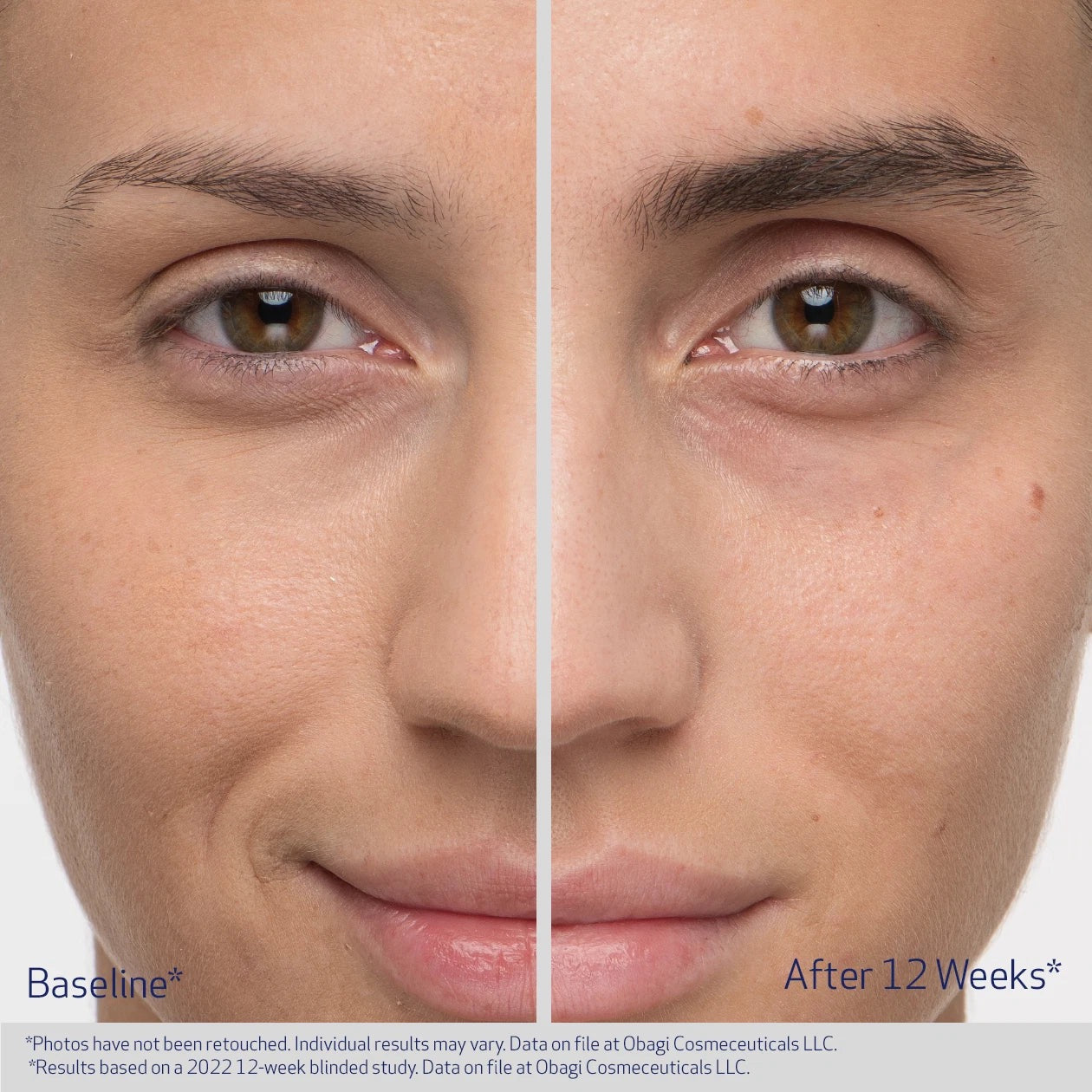 Obagi Eyebrow Boosting Serum